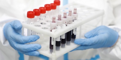 Los fallecidos por el COVID-19 llegan a 408.000 en el mundo, segn la OMS