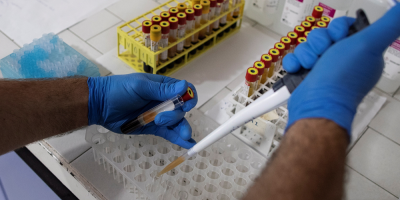 COVID-19 sigue un patr�n estacional y prospera en climas frescos y secos