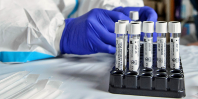 Hay 5 casos nuevos de Coronavirus; todos en Treinta y Tres