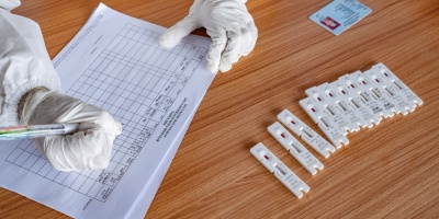 Coronavirus: 1.400 hisopados en Treinta y Tres