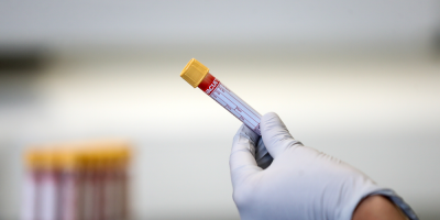 COVID-19: Se registran 83 casos activos de la enfermedad tras detectar 3 nuevos casos