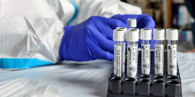 COVID-19: El Sinae report� 73 casos de la enfermedad en el pa�s