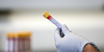 Confirman dos casos de coronavirus COVID-19 en el departamento de Tacuaremb�