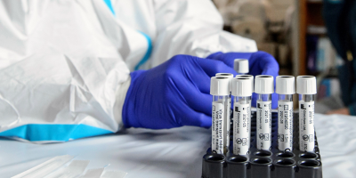 Se detectaron 10 casos nuevos de coronavirus COVID-19