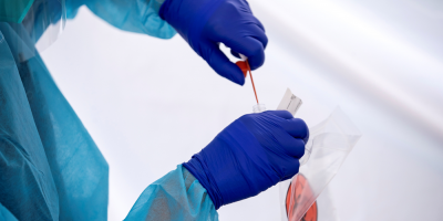Se superaron los 100 casos activos de coronavirus COVID-19, indic� el Sinae