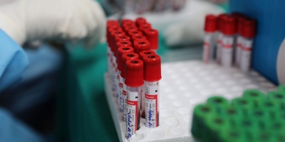 Se confirmaron dos nuevos casos de Covid-19 en Rivera