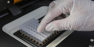 Entre 80 y 90 personas aisladas tras casos positivos de coronavirus en hospitales Pereira Rossell y Pasteur