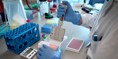 Cient�ficos logran explicar c�mo algunos tumores cerebrales consiguen "esquivar" quimioterapia