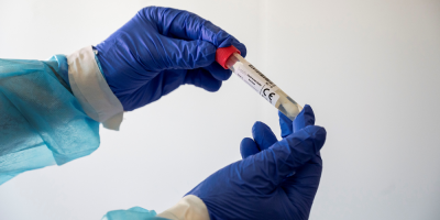 Salud P�blica lleva registrados 76 casos de menores con coronavirus COVID-19
