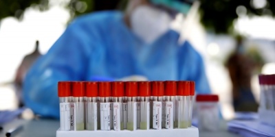 Los casos de coronavirus a nivel mundial ya casi en 22 millones, seg�n la OMS
