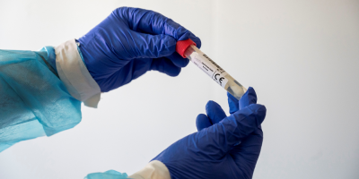 Uruguay registra 196 casos de coronavirus COVID-19 en 10 departamentos
