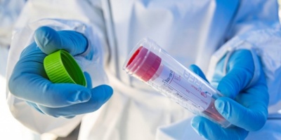 Florida confirma su primer caso de coronavirus