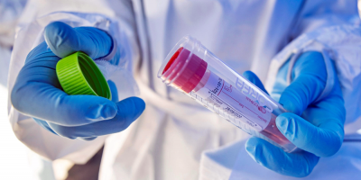 Aument� a 218 el n�mero de personas con COVID-19 tras detecci�n de 31 casos