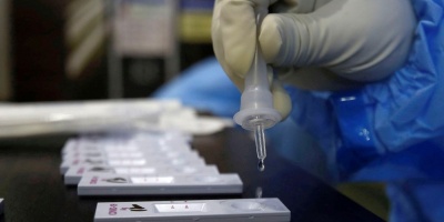 Canelones: 20 casos activos de coronavirus y unas 100 personas en cuarentena