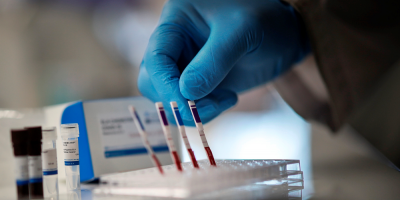 COVID-19: Se detectaron 28 casos positivos nuevos