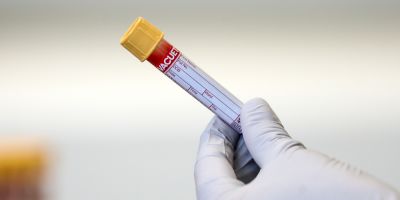 Per� acumul� m�s de 800.000 casos en siete meses de pandemia