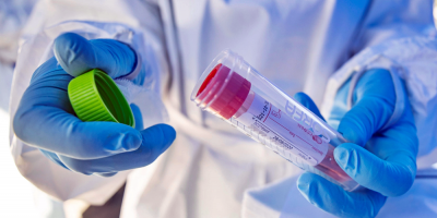 COVID-19: Sinae report� 245 personas con la enfermedad tras detectar 10 casos nuevos