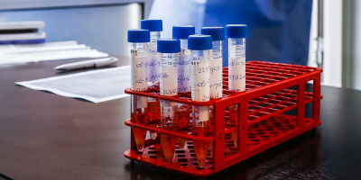 COVID-19: Hay 273 personas con la enfermedad tras detectar 21 casos nuevos