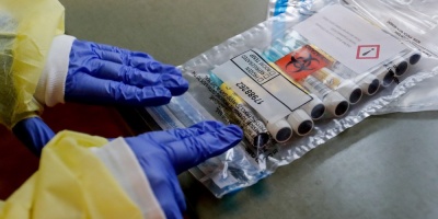 Coronavirus: un fallecido y 17 casos nuevos en Uruguay este s�bado