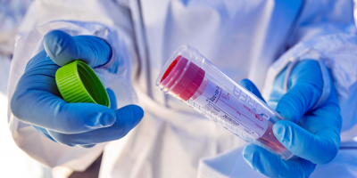 COVID-19: El Sinae report� que hay 444 personas con la enfermedad en todo el pa�s