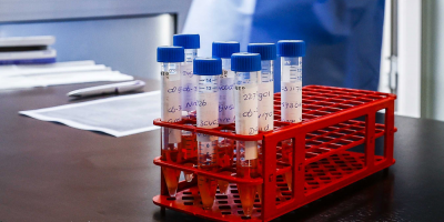 COVID-19: el Sinae registra 447 personas con la enfermedad en el pa�s