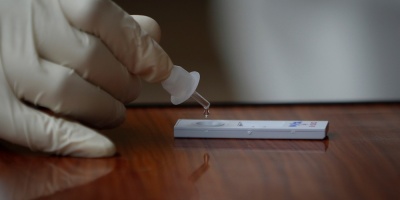 Presentaron el test de coronavirus con resultado en una hora que se utilizar� en Tacuaremb� para cirug�as de urgencia