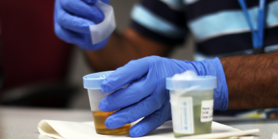 Paraguay se prepara para temporada de dengue mientras la covid se mantiene