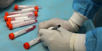 Prestadores de salud tendr�n 48 horas para realizar hisopados de COVID-19 y entregar resultados