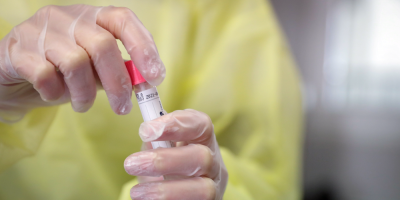 COVID-19: Un nuevo r�cord al detectarse 238 casos de la enfermedad