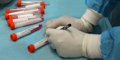 La cifra de fallecimientos por Covid-19 lleg� a 90 y se detectaron casi 400 casos