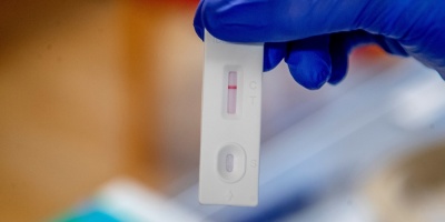 Coronavirus Uruguay: cinco fallecidos este s�bado y 610 casos nuevos