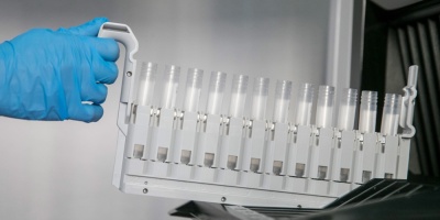 VUI-202012/01, una variante del SARS-Cov-2 llena a�n de inc�gnitas