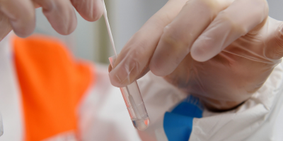 COVID-19: se registraron ocho fallecimientos y 522 nuevos casos 