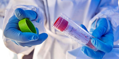 Covid-19: hay un total de 6.478 personas con la enfermedad en el pa�s