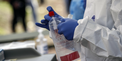 Once fallecimientos por Covid-19 y leve descenso en el n�mero de casos activos