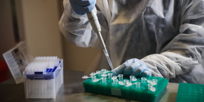 En 40 % de los casos de Covid-19 no se ha identificado nexo de contagio