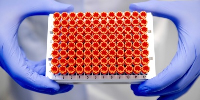 Coronavirus en Uruguay: seis fallecidos este s�bado y 652 casos nuevos