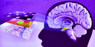 El origen �tnico puede aumentar el riesgo de padecer mal de Alzheimer