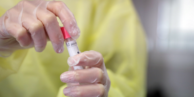 Confirmaron siete nuevos fallecimientos por Covid-19 y hay 5.476 personas con la enfermedad