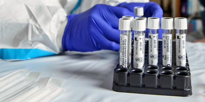 Uruguay super� los 500 muertos por covid-19 desde el inicio de la pandemia