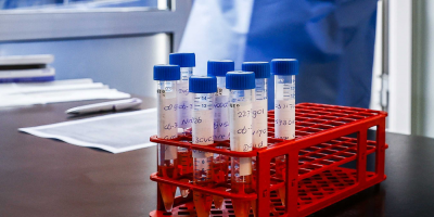 Los casos globales diarios bajan a 220.000, la menor cifra en casi medio a�o