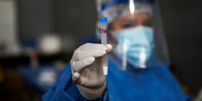 Se alcanz� r�cord total de positivos de covid-19 al superar los 50.000