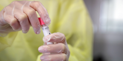 Sinae report� un total de 7.354 personas con Covid-19 en todo el pa�s