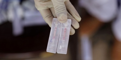 Coronavirus en Uruguay: 1.062 casos nuevos y 9 fallecidos este s�bado