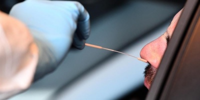 La p�rdida de olfato anticipa un buen pron�stico para pacientes con covid-19