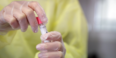 Se duplic� demanda de PCR que procesan los laboratorios desde febrero