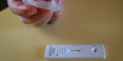 Director del Hospital Tacuaremb�: el coronavirus P1 estar� en todo el pa�s en poco tiempo