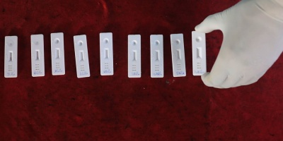 MSP defini� realizar test de ant�genos para casos sospechosos de Covid-19