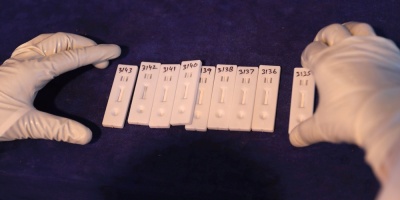 Analizan brote de coronavirus en Lascano