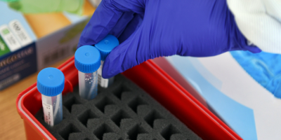 Brasil registra reducci�n en n�mero diario de muertes y contagios por covid